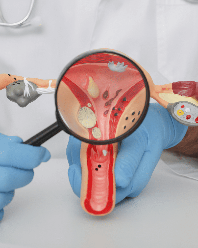 ginecologo-especialista-en-mastologia